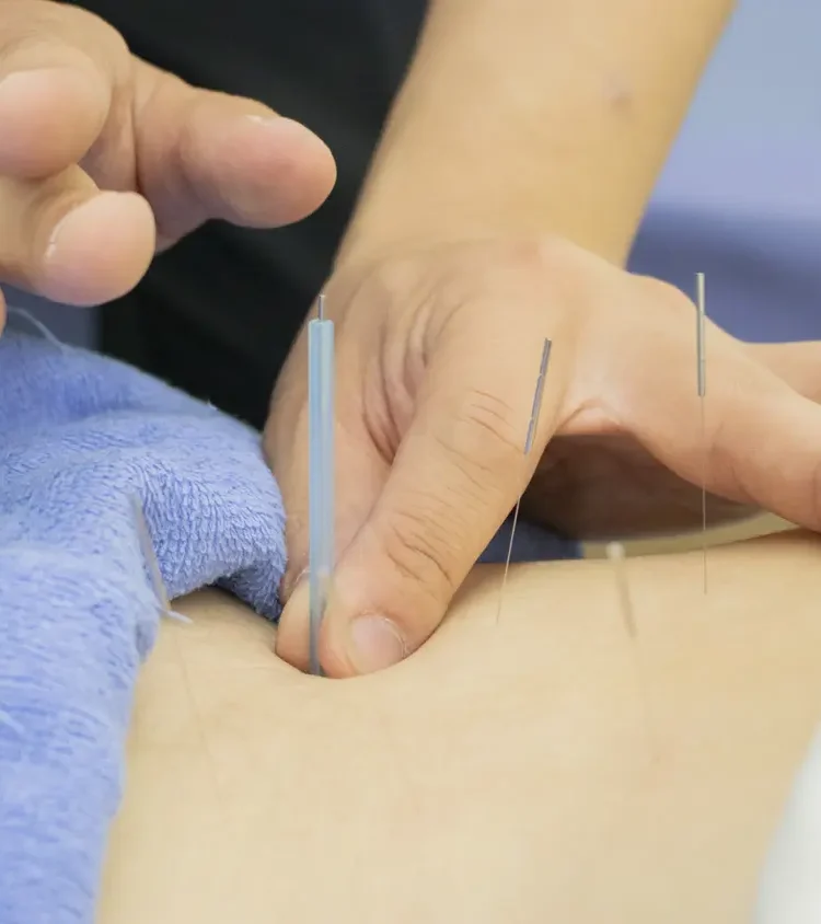何も知らないから怖く思える鍼治療！やってみたいけど・・・という方は