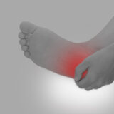 かかとが痛くて歩けない…成長期に多い“踵骨骨端炎”のケアとは？